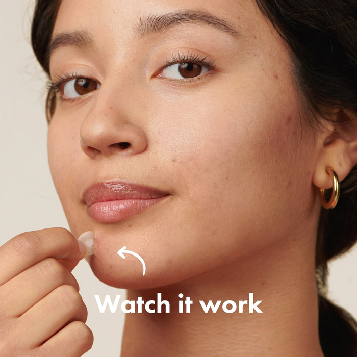 Hero Mighty Patch Original Acne Adhesive Patches