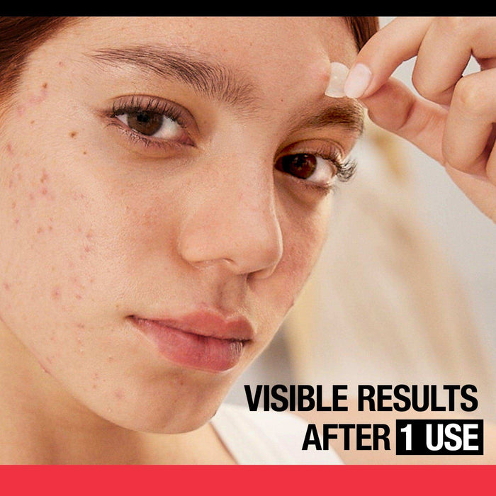 Neutrogena Stubborn Acne Blemish Patch Ultra-Thin Hydrocolloid - 24Ct - Elvoros