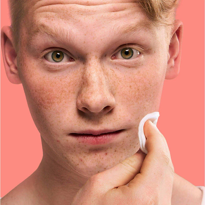 Clean & Clear Essentials Oil-Free Deep Cleaning Astringent, 8 fl. oz - Elvoros